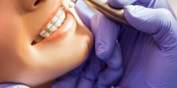What Does an Orthodontist Do? Your Complete Guide