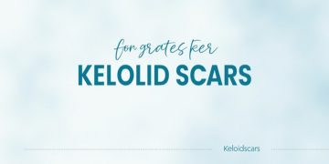 Keloid Scars