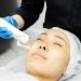 RF Microneedling Benefits